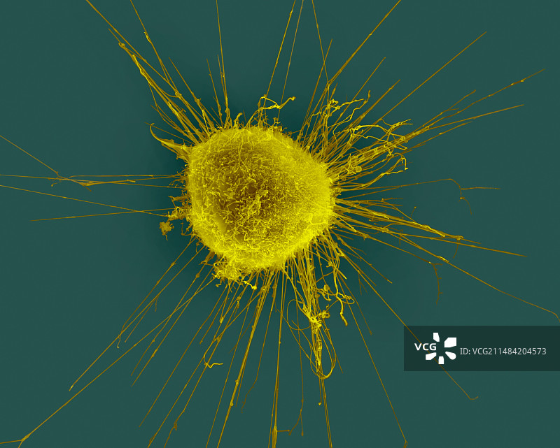 乳腺上皮癌细胞扫描电镜图图片素材