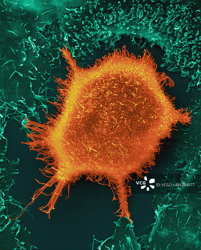 肺上皮癌细胞扫描电镜图图片素材