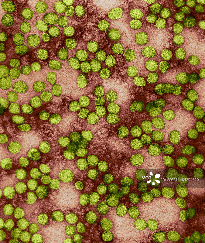 黄热病病毒，TEM图片素材