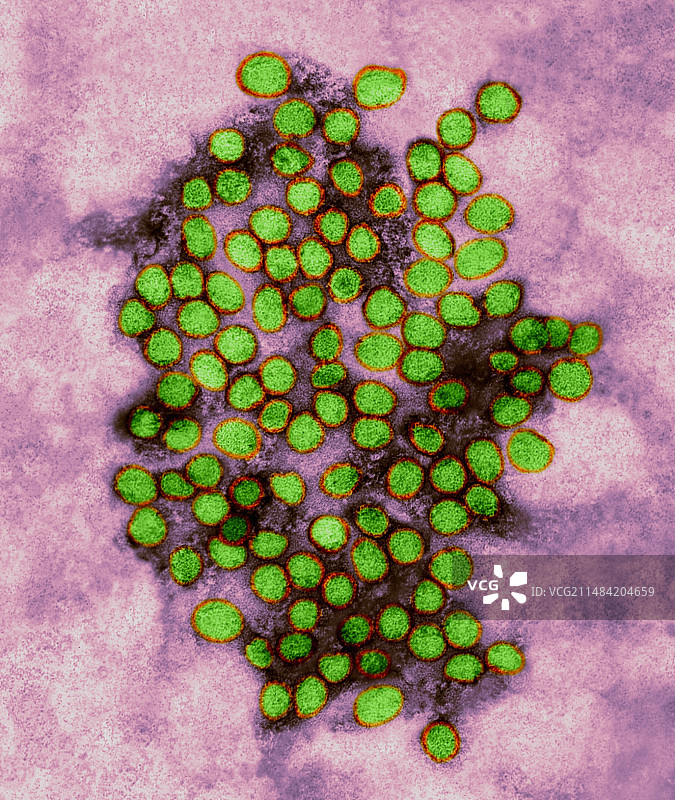 黄热病病毒，TEM图片素材