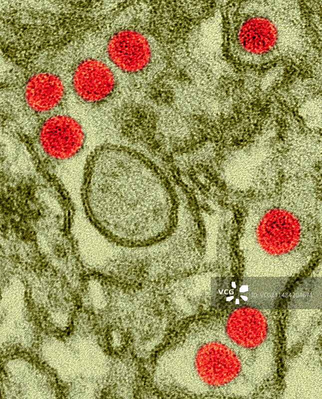 寨卡病毒扫描电镜图图片素材