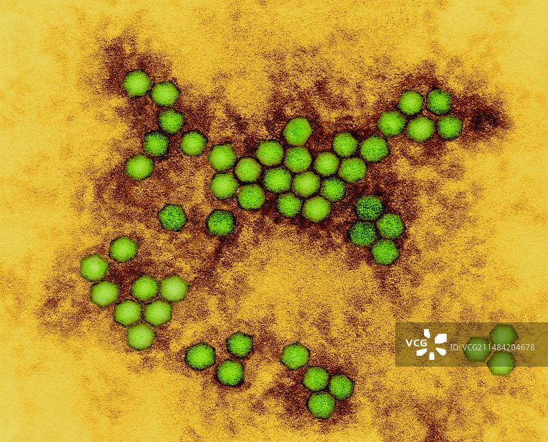 脊髓灰质炎病毒透射电镜图图片素材