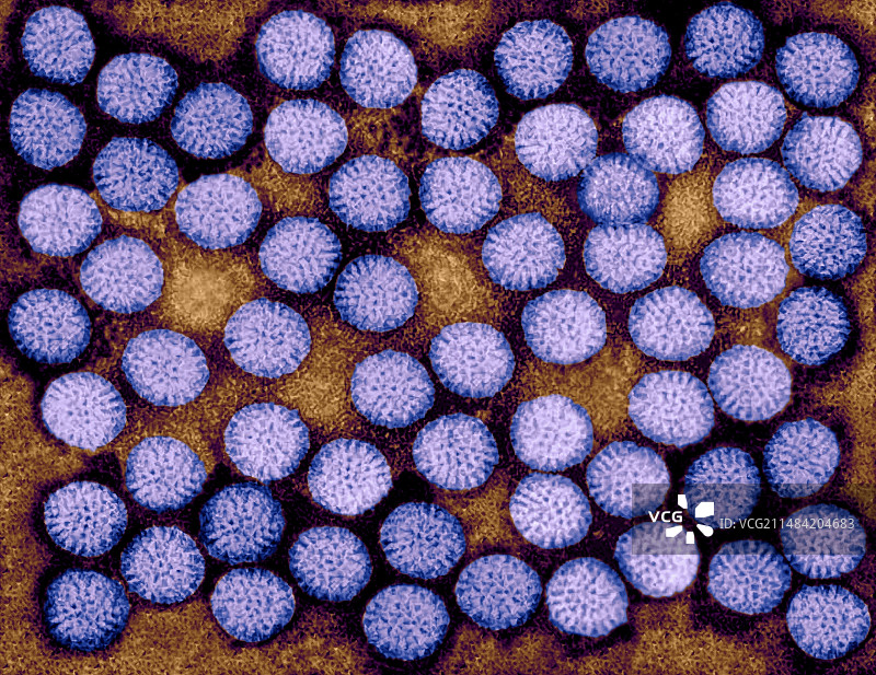轮状病毒，透射电子显微镜图片素材