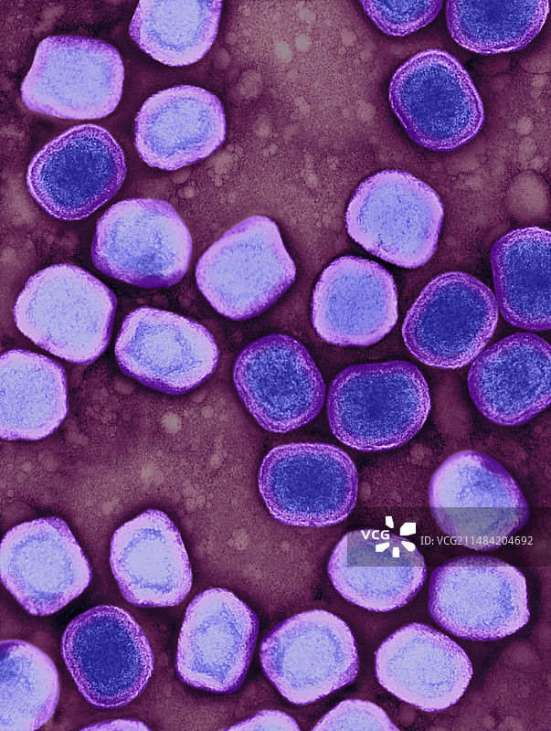 天花病毒，导致天花的病原体，TEM图片素材