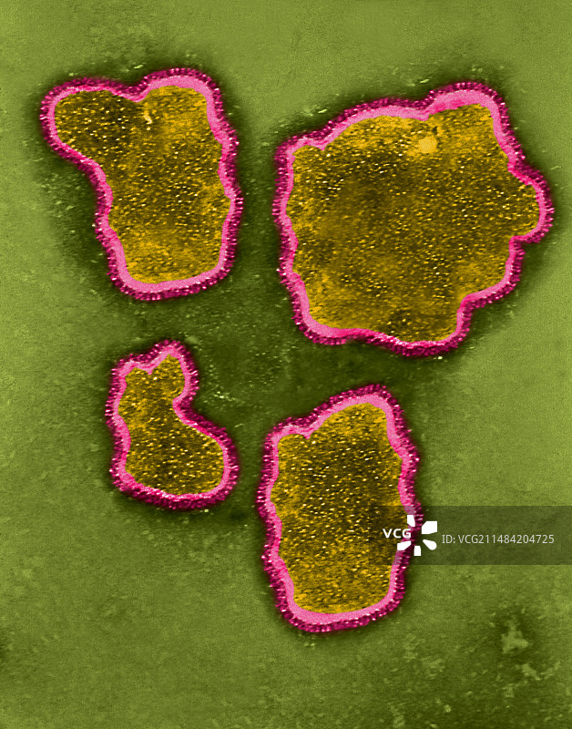 呼吸道合胞病毒，透射电镜图片素材