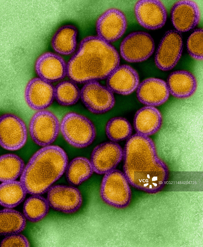 人甲型H1N1流感病毒，TEM图片素材