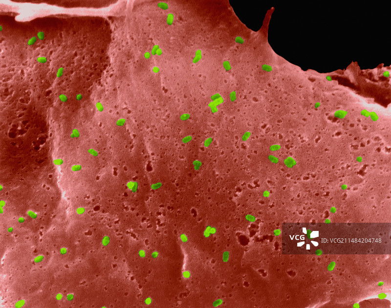 拉布多病毒感染的上皮细胞扫描电镜图图片素材