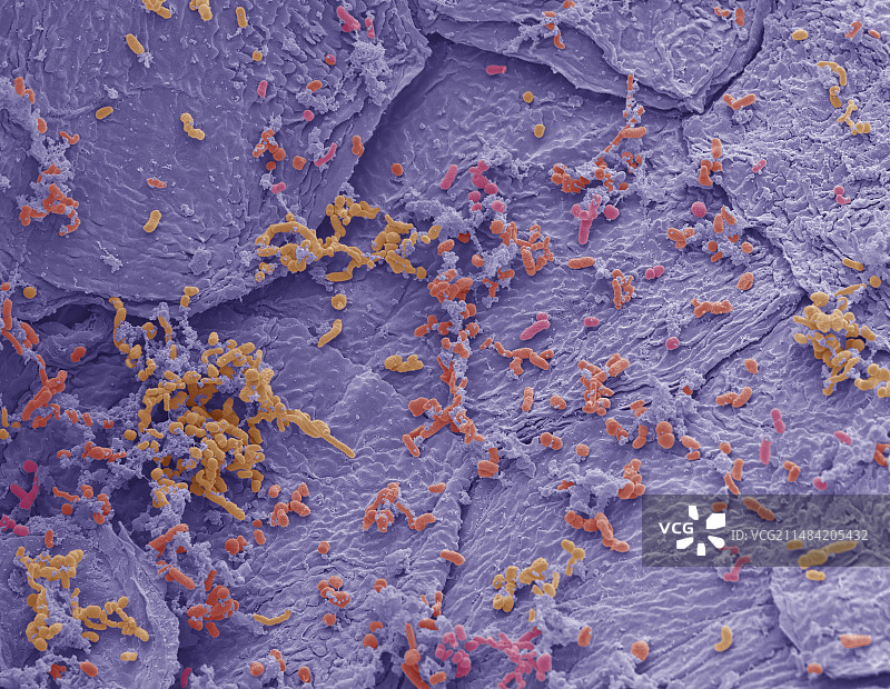 细菌性皮肤感染，扫描电子显微镜图片素材