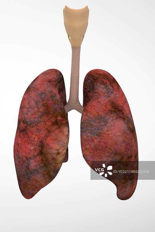 吸烟者的肺部插图图片素材