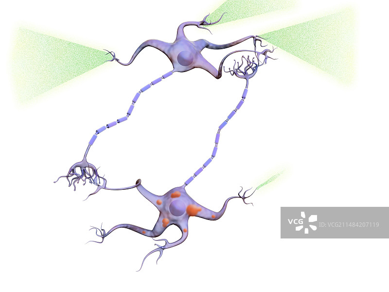 帕金森病中的神经元图片素材