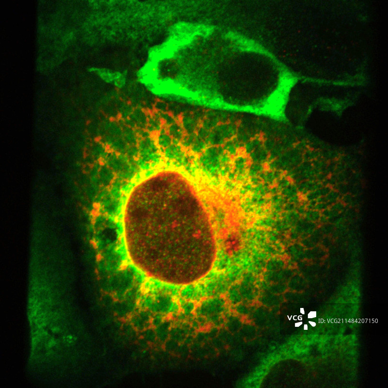 人乳头瘤病毒癌症研究图片素材