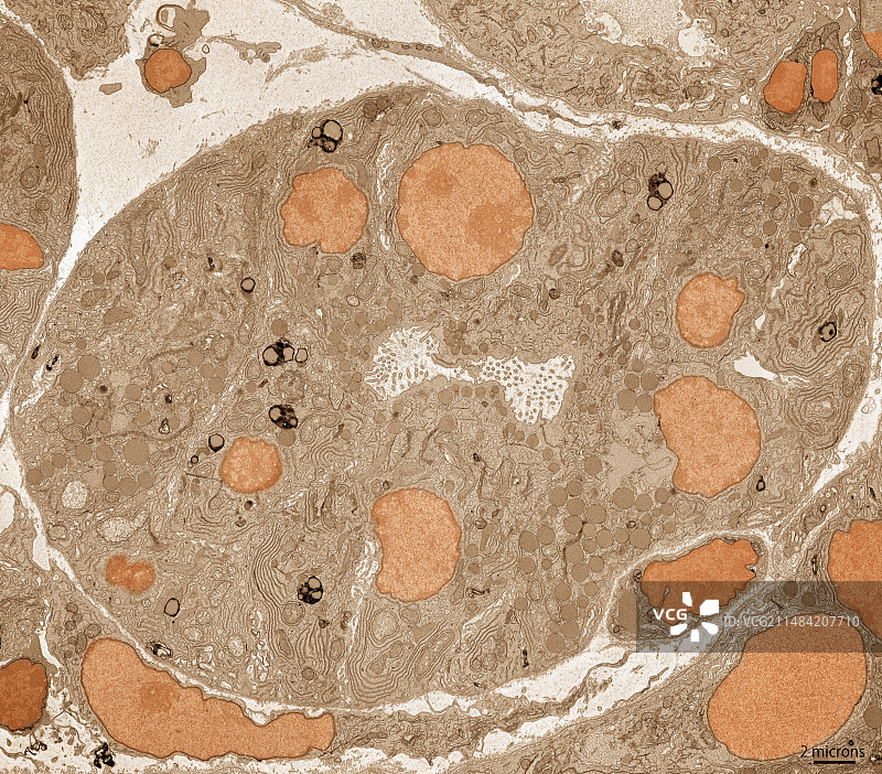 胰腺腺泡细胞图片素材