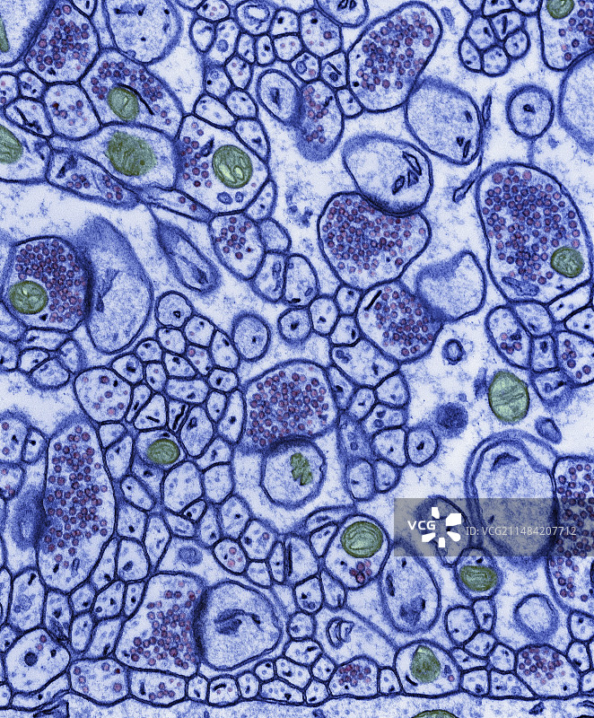 小脑中的突触（透射电镜）图片素材