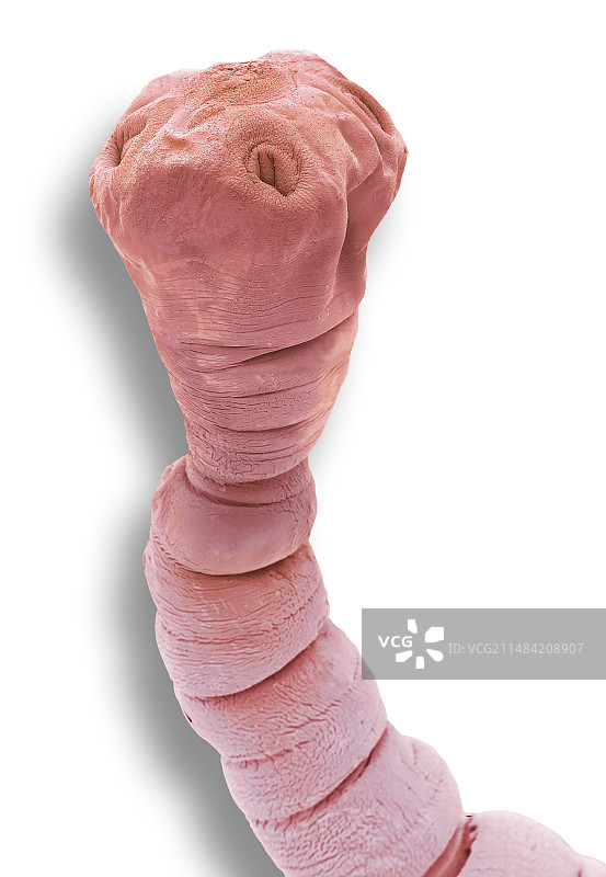 绦虫中绦期幼虫，扫描电镜图片素材