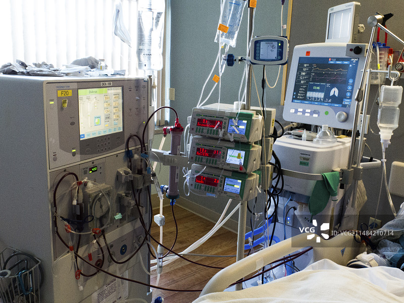 重症监护室的肾透析图片素材