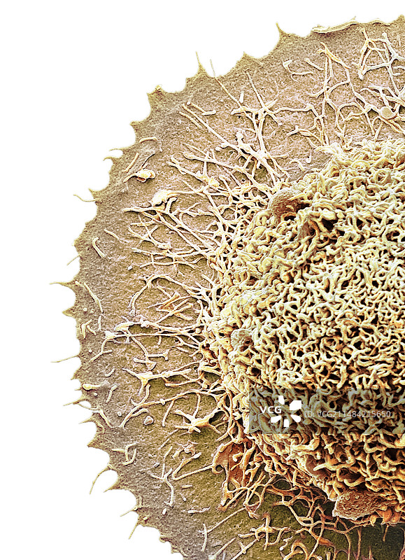 结直肠癌细胞，扫描电子显微镜图片素材