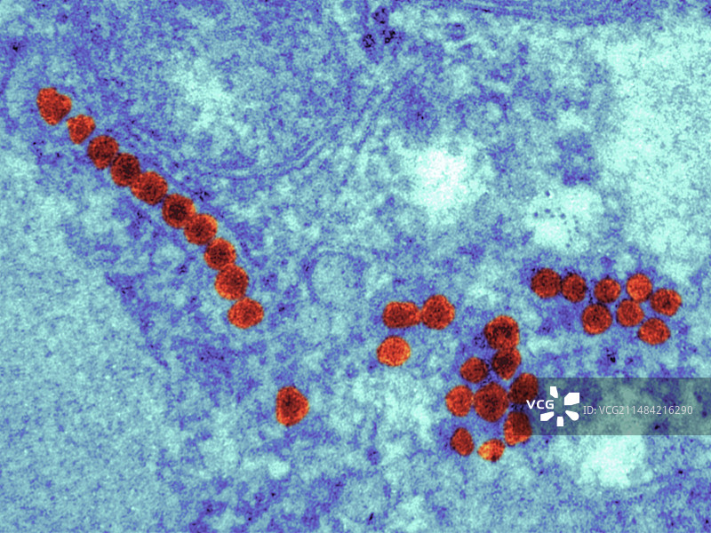 寨卡病毒颗粒TEM图片素材