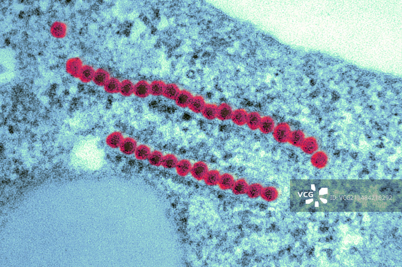 寨卡病毒颗粒TEM图片素材