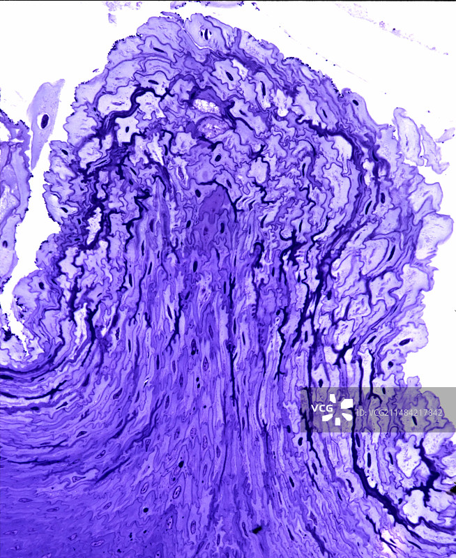 鳞状上皮细胞显微照片图片素材