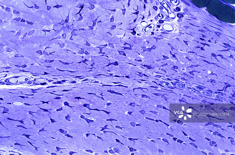 肌腱显微照片图片素材