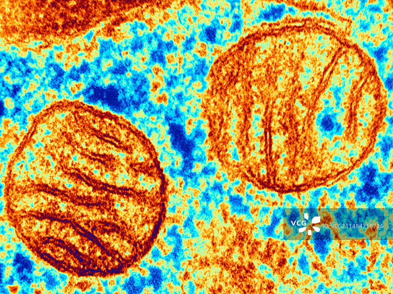 肺线粒体，TEM图片素材