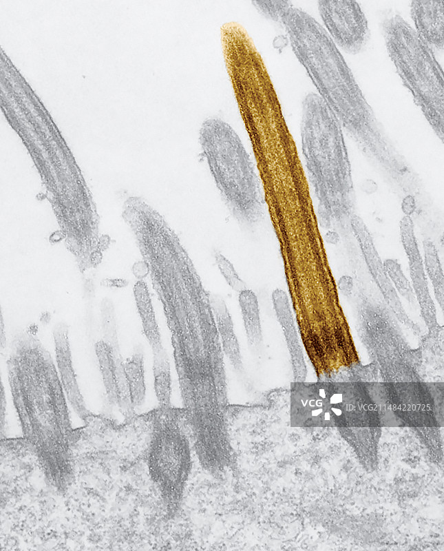 突变小鼠胃纤毛透射电镜图片素材