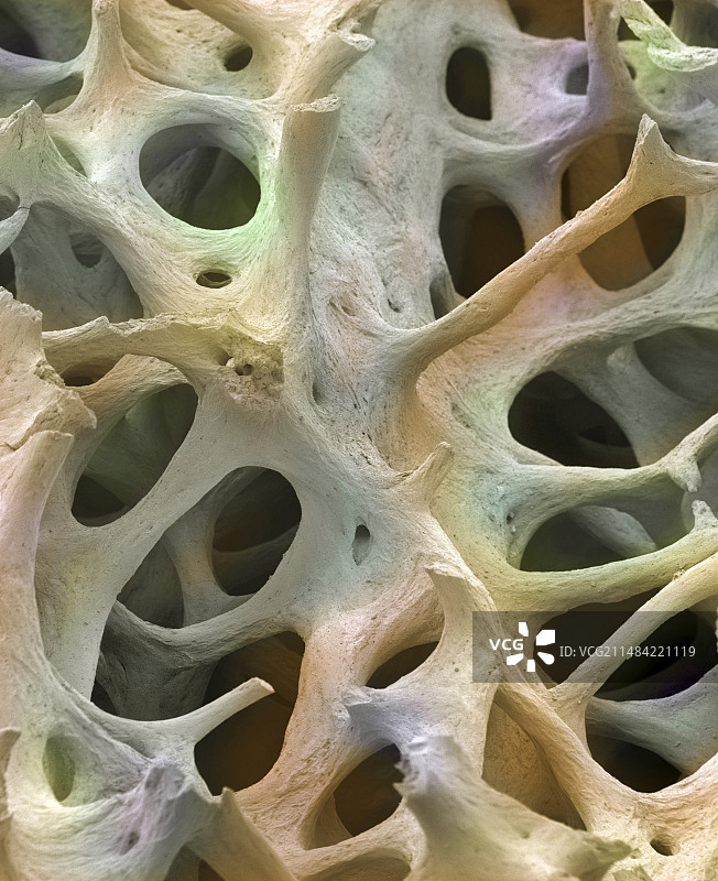 骨组织扫描电镜图图片素材