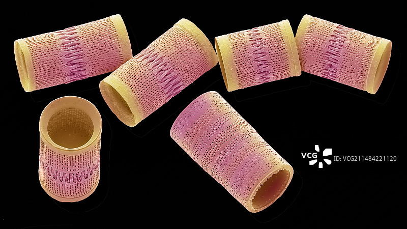 Aitalica硅藻，扫描电镜图片素材