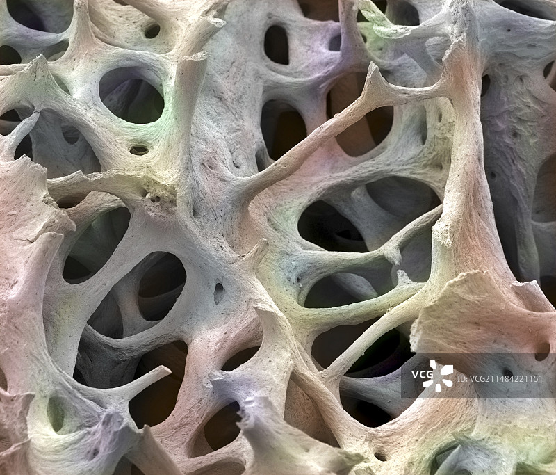 骨组织扫描电镜图图片素材
