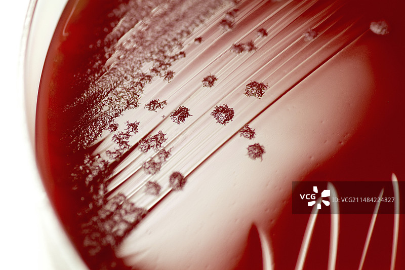 艰难梭菌细菌培养图片素材