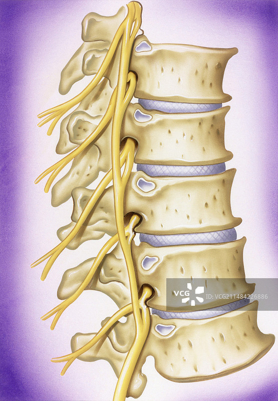 椎骨骨关节炎插图图片素材