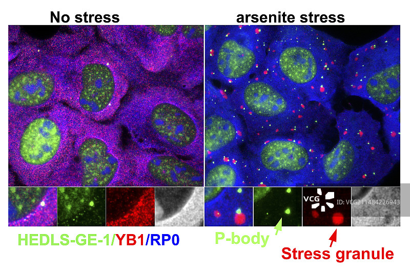 亚砷酸盐胁迫细胞光显微照片图片素材