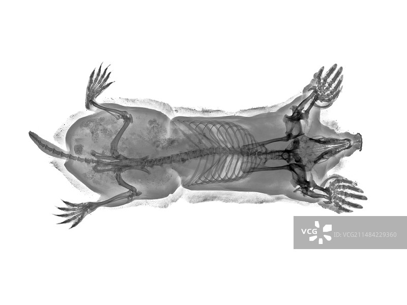 X光下的痣图片素材