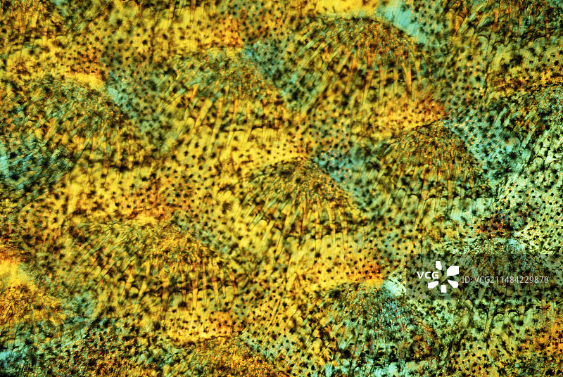 脚底皮肤偏光显微照片图片素材