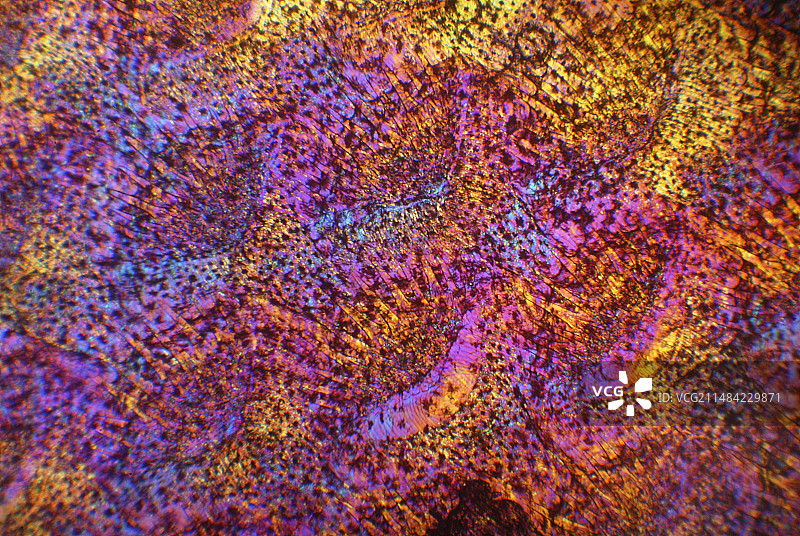 脚底皮肤偏光显微照片图片素材