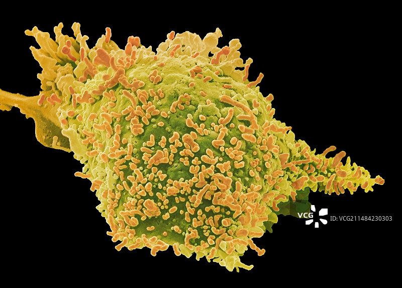 纤维肉瘤细胞扫描电镜图图片素材