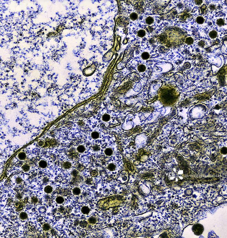 单纯疱疹病毒感染，TEM图片素材