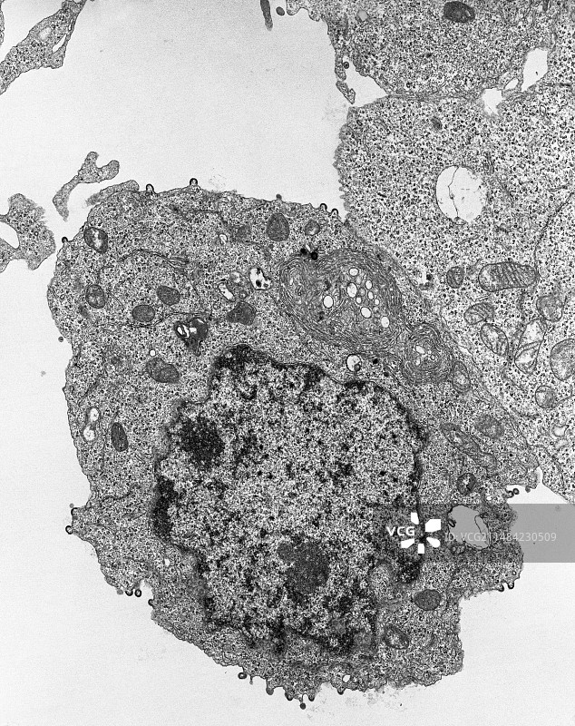 艾滋病病毒感染TEM图片素材