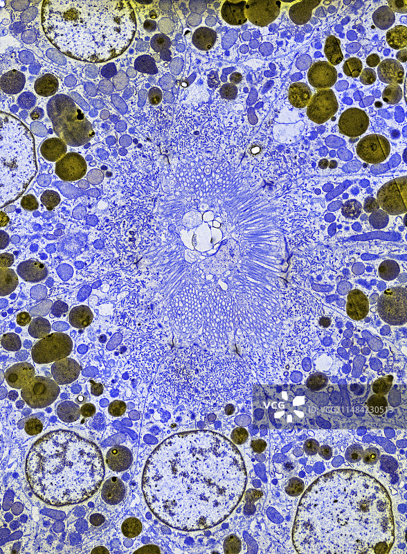 肾脏组织TEM图片素材