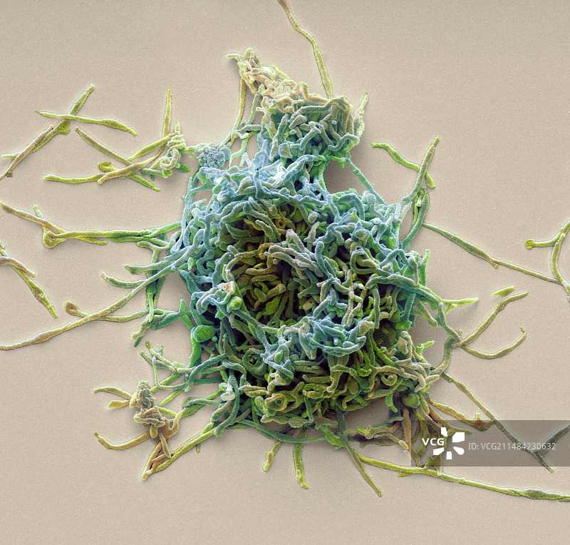 肺炎支原体，扫描电镜图片素材