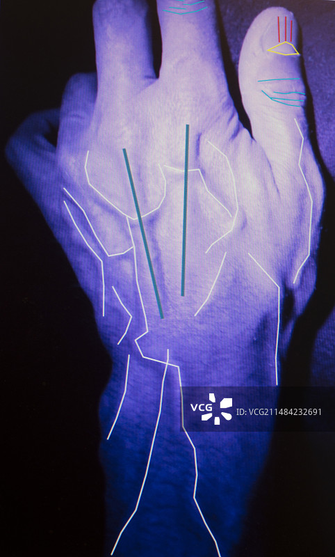 手部识别研究图片素材