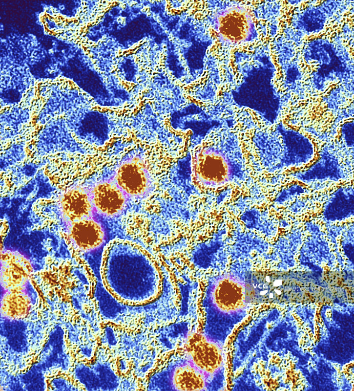 寨卡病毒TEM图片素材