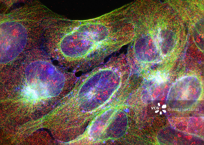 骨肉瘤细胞显微照片图片素材