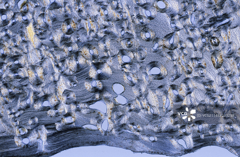 骨骼，光学显微照片图片素材