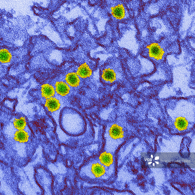 寨卡病毒TEM图片素材