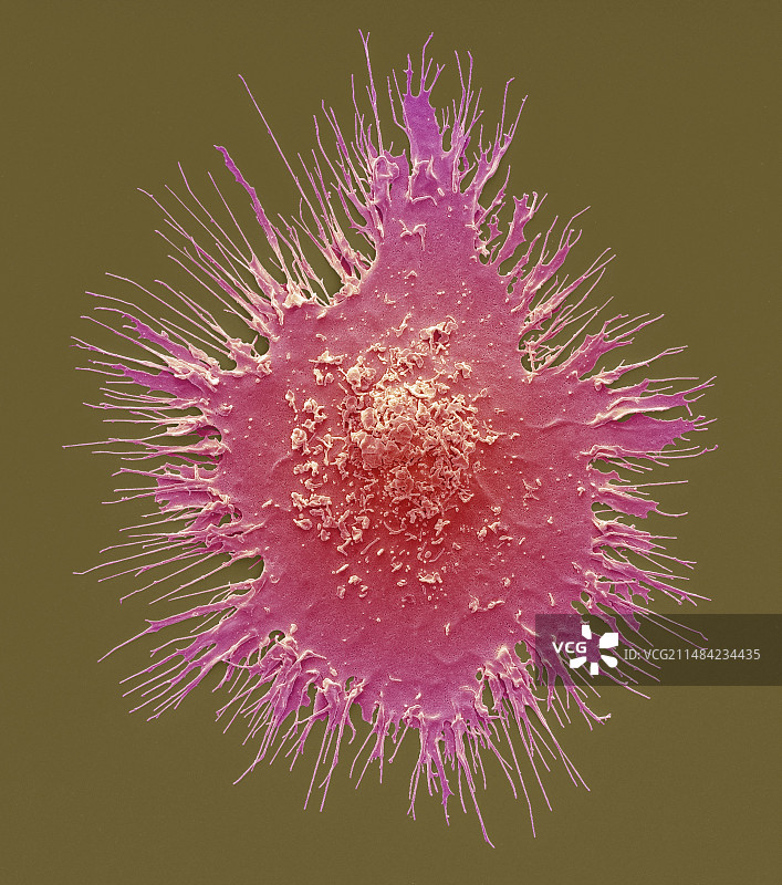 树突状细胞扫描电镜图图片素材