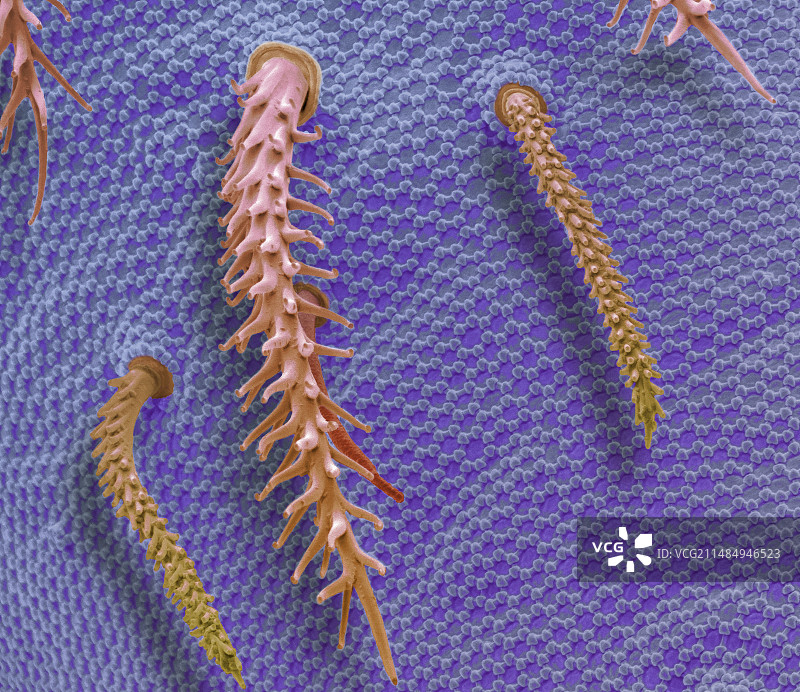 球潮虫身体，扫描电镜图图片素材