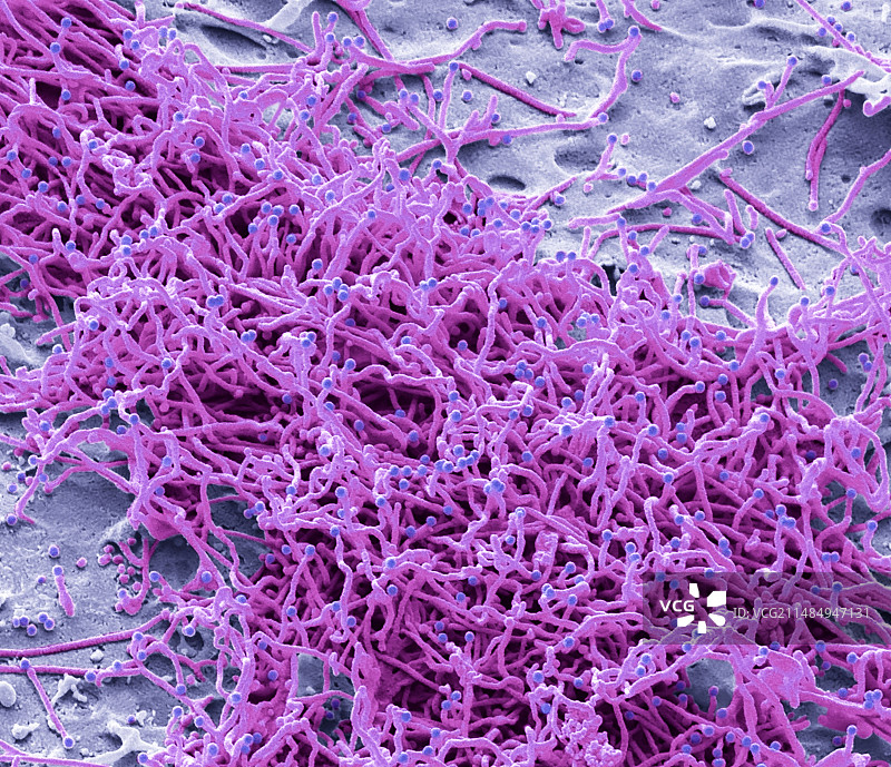 艾滋病毒感染细胞，扫描电镜图片素材