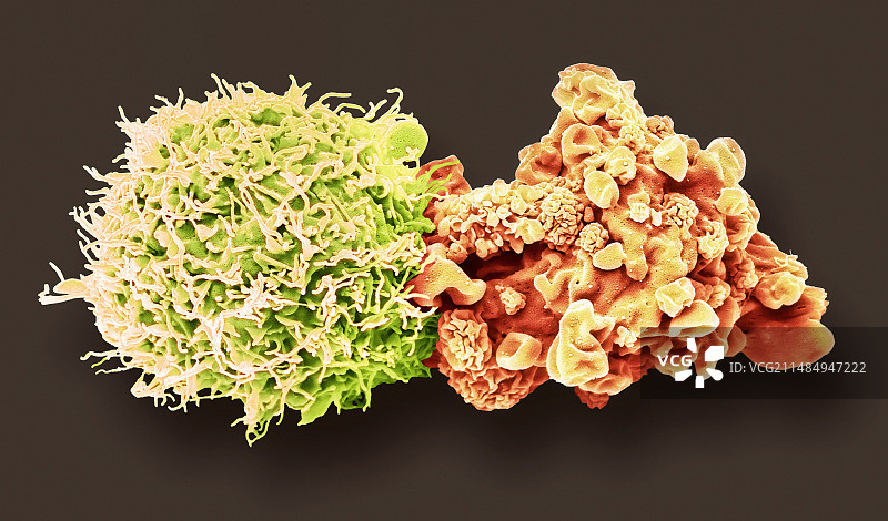 脑癌细胞扫描电镜图图片素材