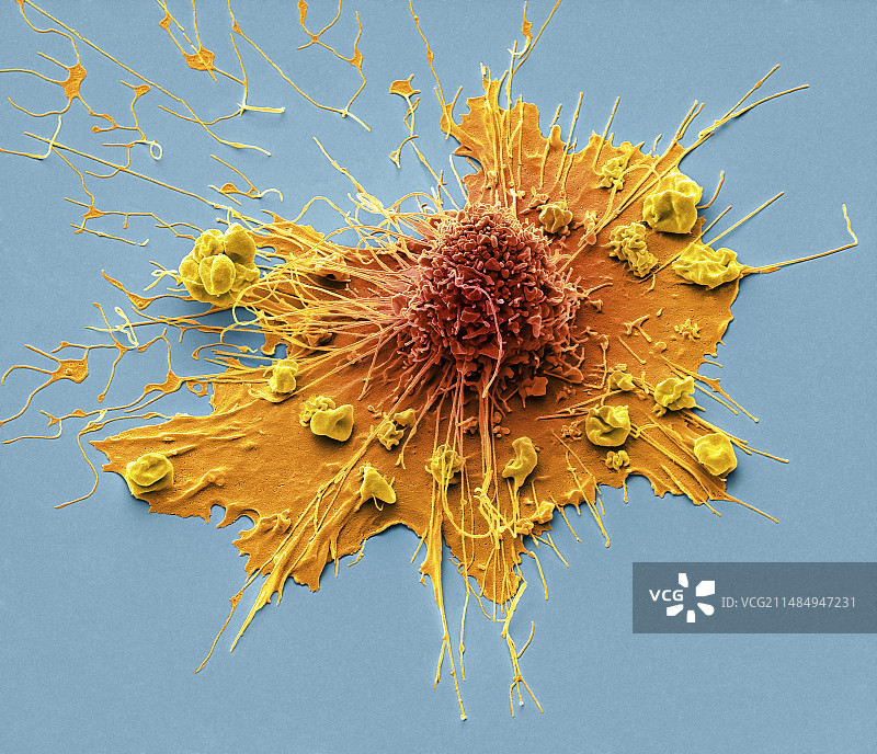 成纤维细胞扫描电镜图图片素材